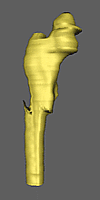 Split femur