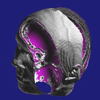 Head cut by a moving cutter