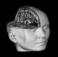 volumetric head