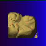 initial tooth