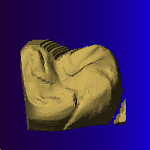 reconstructed tooth